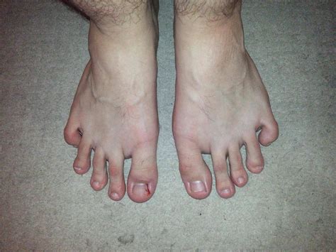 ugly feet pics|4,164 Free images of Ugly Feet